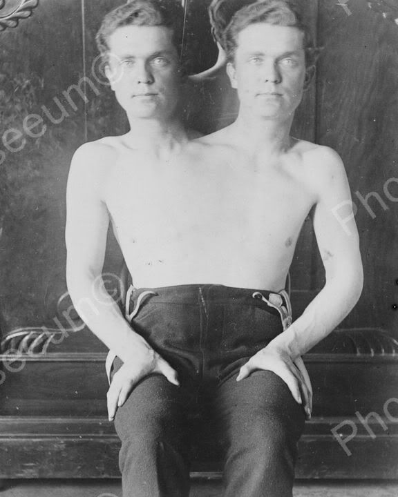 Conjoined Two Headed Man 1901 8x10 Reprint Of Old Photo Photoseeum